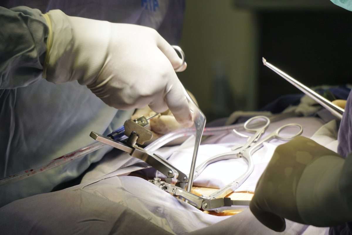 Chirurgie ouverte du rachis (approche conventionnelle)